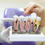 Root Canal Treatment Side Effects Explained